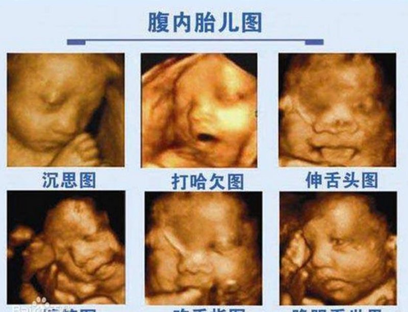 厦门湖里区阳光公寓在哪里？让我们通过故事化叙述，带你一起探索这个充满阳光的地方。